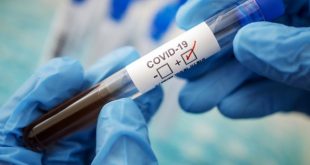 Covid-19 НЕ ВІДСТУПАЄ. ПІДТВЕРДЖЕНО 21 НОВИЙ ВИПАДОК ЗАХВОРЮВАННЯ