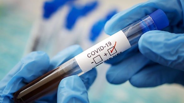 Covid-19 НЕ ВІДСТУПАЄ. ПІДТВЕРДЖЕНО 21 НОВИЙ ВИПАДОК ЗАХВОРЮВАННЯ